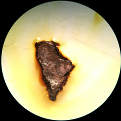 Hypoxylon perforatum