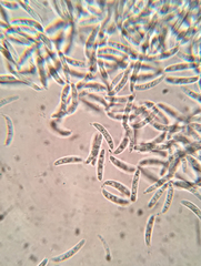 Pseudolachnea hispidula