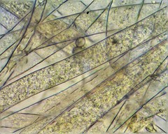 Rhizopus stolonifer