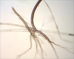 Rhizopus stolonifer