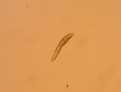 Bdelloidea