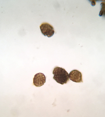 Berkleasmium conglobatum