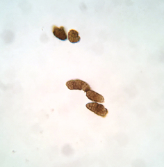 Berkleasmium conglobatum