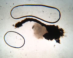 Barbatosphaeria barbirostris