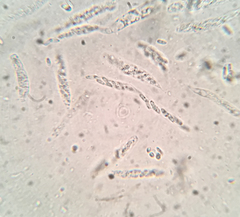 Barbatosphaeria barbirostris