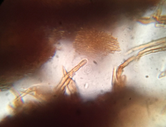 Barbatosphaeria barbirostris