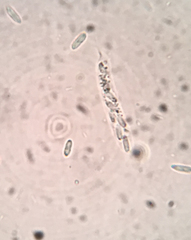 Barbatosphaeria barbirostris