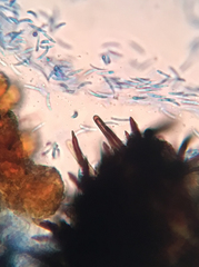 Pseudolachnea hispidula
