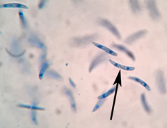 Pseudolachnea hispidula