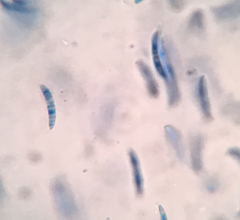 Pseudolachnea hispidula