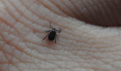 Ixodes ricinus