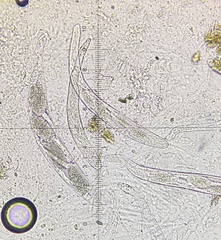 Podospora australis
