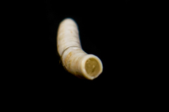 Caecum