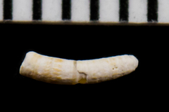 Caecum