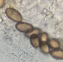 Ascobolus albidus