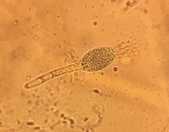 Podospora decipiens
