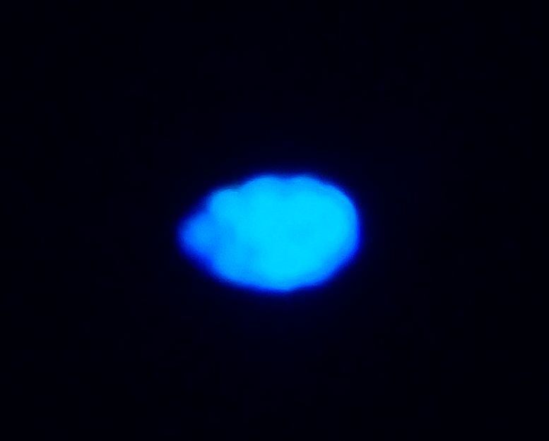 Sea sparkle (Noctiluca scintillans)