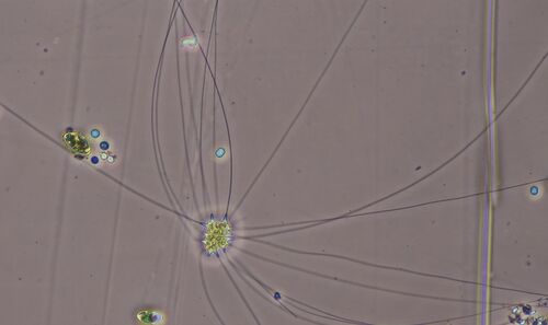 Chaetosphaeridium pringsheimii
