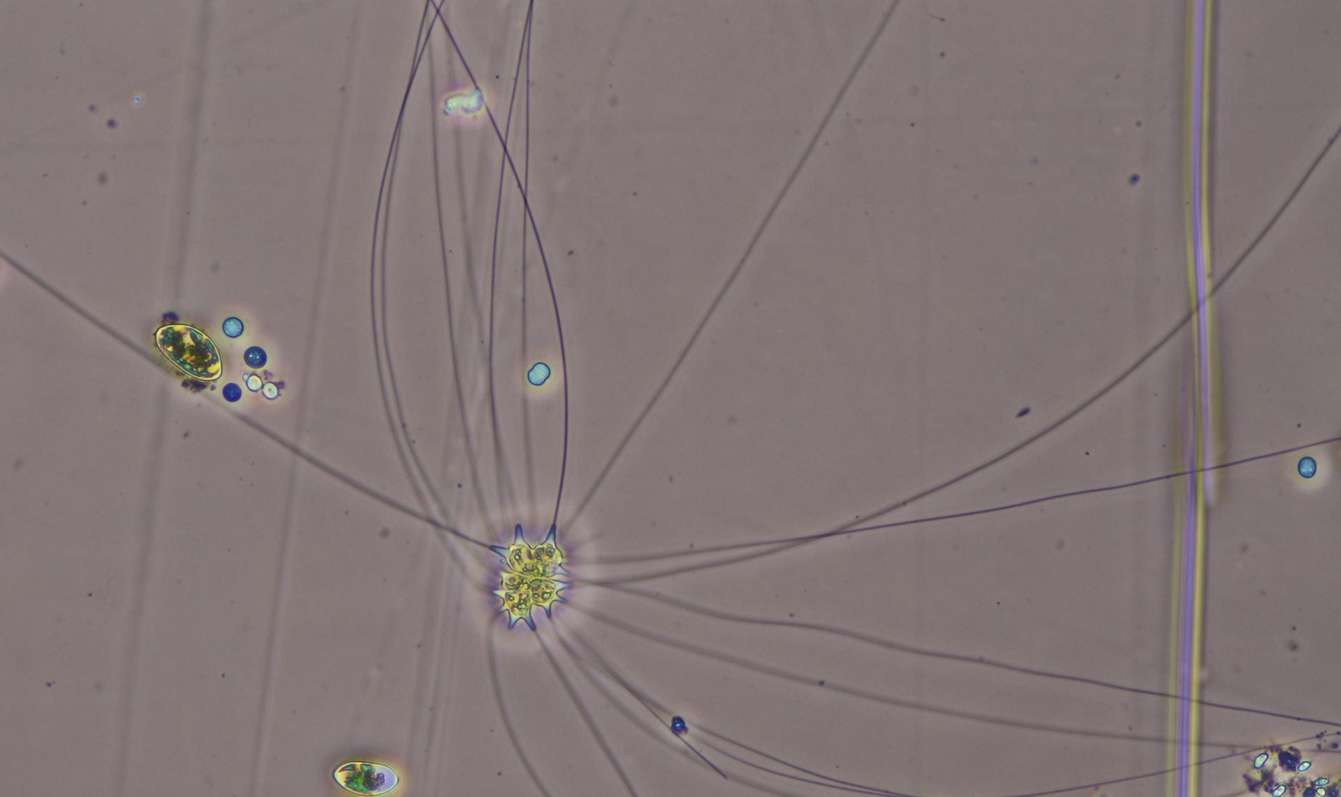 Chaetosphaeridium pringsheimii