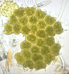 Pseudopediastrum boryanum longicorne
