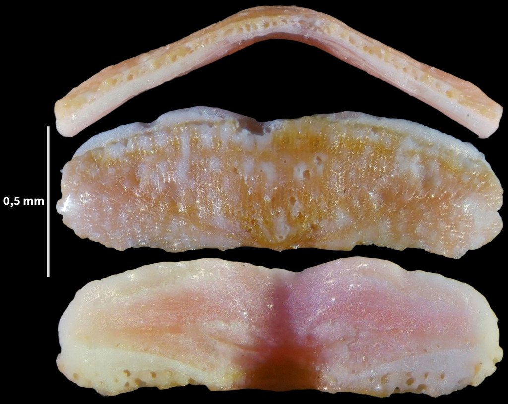 Callochiton doriae