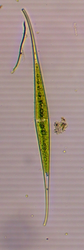 Closterium rostratum