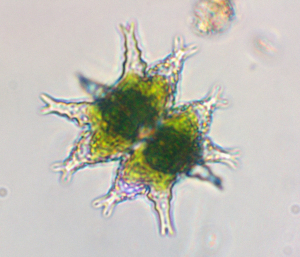 Staurastrum furcigerum