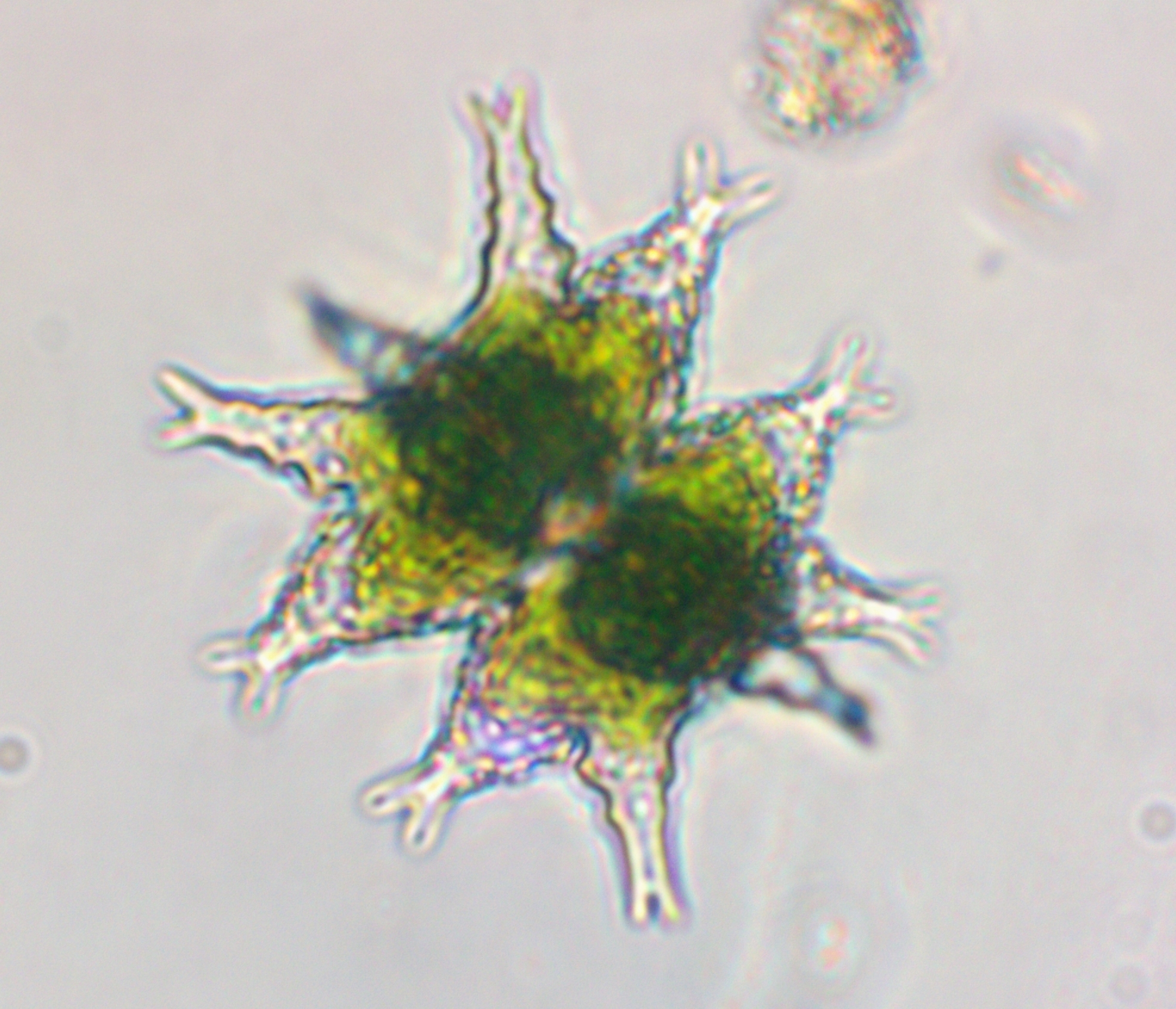 Staurastrum furcigerum