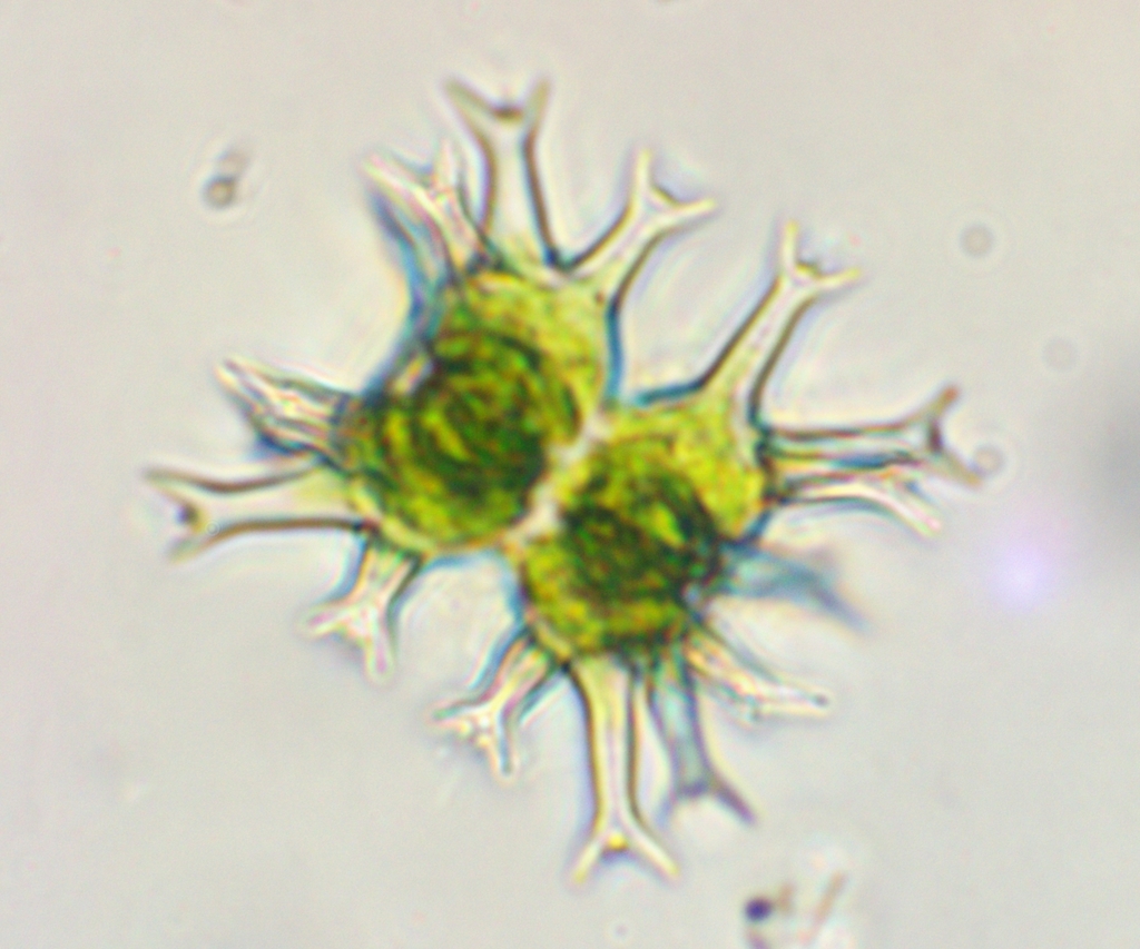 Staurastrum tohopekaligense