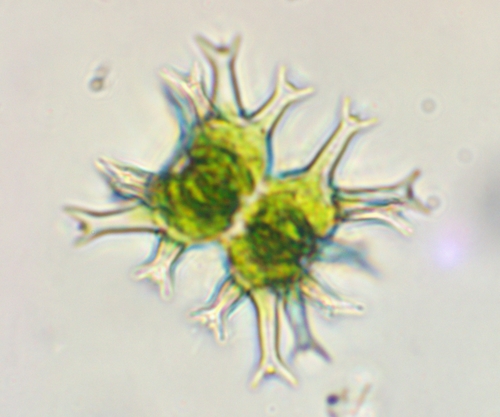 Staurastrum tohopekaligense