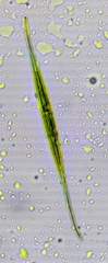 Closterium rostratum