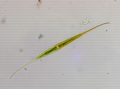 Closterium rostratum