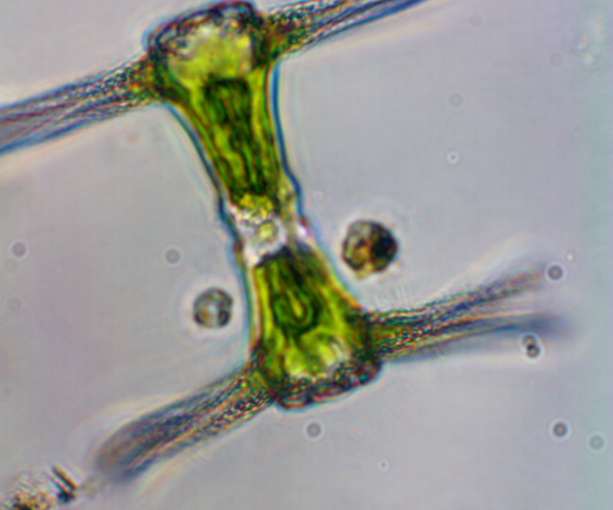 Staurastrum ankyroides