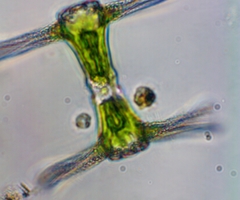 Staurastrum ankyroides