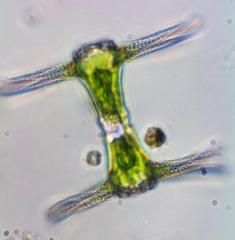 Staurastrum ankyroides