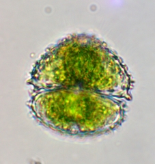 Staurastrum claviferum