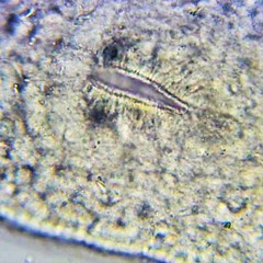Macrostomum