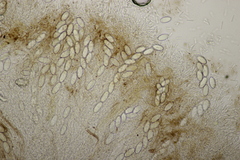 Pseudombrophila hepatica