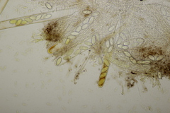 Pseudombrophila hepatica