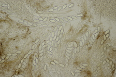 Pseudombrophila hepatica