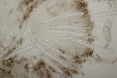 Pseudombrophila hepatica