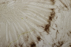 Pseudombrophila hepatica