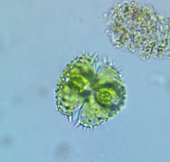 Staurastrum claviferum