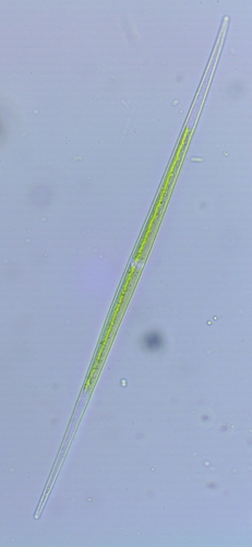 Closterium acutum