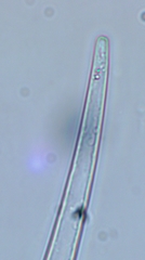 Closterium acutum