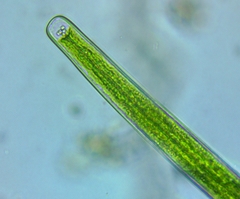 Closterium angustatum
