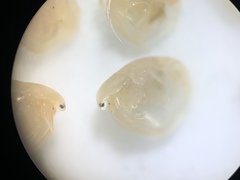 Simocephalus