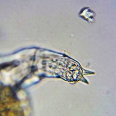 Philodina megalotrocha