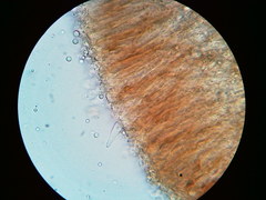 Cylindrobasidium laeve