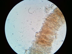 Cylindrobasidium laeve
